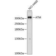 Western blot analysis of extracts of H460 cells using ATM Antibody (1/1000 dilution).