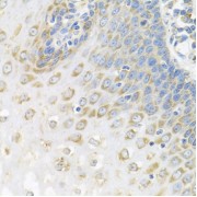 Immunohistochemistry of paraffin-embedded Human esophagus using AntibodyPC4 Antibody (1/100 dilution, 40x lens).