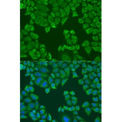 Poly(A) Binding Protein Cytoplasmic 4 (PABPC4) Antibody