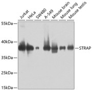 Western blot analysis of extracts of various cell lines using STRAP Antibody (1/1000 dilution).