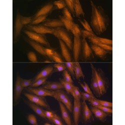 Serine-Threonine Kinase Receptor-Associated Protein (STRAP) Antibody