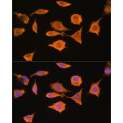 Serine-Threonine Kinase Receptor-Associated Protein (STRAP) Antibody