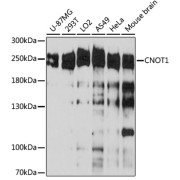 Western blot analysis of extracts of various cell line using CNOT1 Antibody (1/3000 dilution).