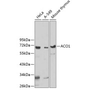 Western blot analysis of extracts of various cell lines using UTP3 Antibody