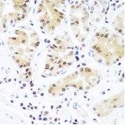 Immunohistochemistry of paraffin-embedded Human stomach using Argonaute-2 Antibody (1/100 dilution, 40x lens).