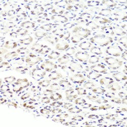 Pre-mRNA Processing Factor 8 (PRPF8) Antibody