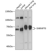 Western blot analysis of extracts of various cell lines using SNRNP70 Antibody (1/1000 dilution).