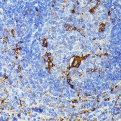 Nucleolysin TIAR (TIAL1) Antibody