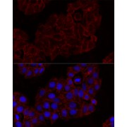 Immunofluorescence analysis of HeLa cells using KLRK1 Antibody (1/100 dilution). Blue: DAPI for nuclear staining.