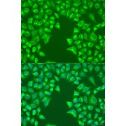 Immunofluorescence analysis of U2OS cells using LRP6 Antibody (1/100 dilution). Blue: DAPI for nuclear staining.