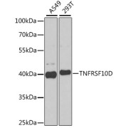 Western blot analysis of extracts of various cell lines using TNFRSF10D Antibody (1/1000 dilution).