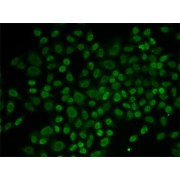 Immunofluorescence analysis of MCF-7 cells using RAD54L2 Antibody