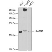 Western blot analysis of extracts of various cell lines using HMGN2 Antibody (1/1000 dilution).