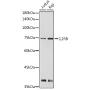 Western blot analysis of extracts of various cell lines using IL2RB Antibody (1/500 dilution).