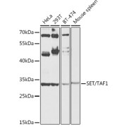 Western blot analysis of extracts of various cell lines using SET/TAF1 Antibody (1/1000 dilution).