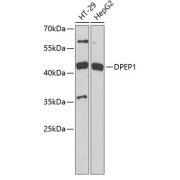 Western blot analysis of extracts of various cell lines using DPEP1 Antibody (1/1000 dilution).