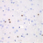 Immunohistochemistry of paraffin-embedded Rat brain using TKT Antibody (1/100 dilution, 40x lens).