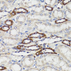 B-Cell Receptor Associated Protein 29 (BCAP29) Antibody