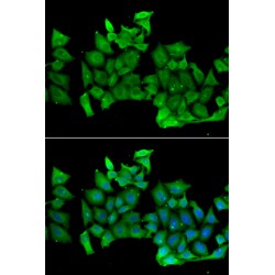 Ras Homolog Family Member H (RHOH) Antibody