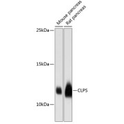 Western blot analysis of extracts of various cell lines using CLPS Antibody (1/3000 dilution).