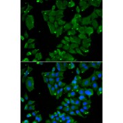 Immunofluorescence analysis of HeLa cells using DBN1 Antibody