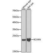 Western blot analysis of extracts of various cell lines using RCVRN Antibody (1/1000 dilution).