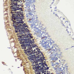 Recoverin (RCVRN) Antibody