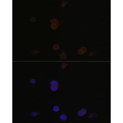 Recoverin (RCVRN) Antibody