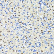 Immunohistochemistry of paraffin-embedded Rat ovary using TRIM27 Antibody (1/100 dilution, 40x lens).