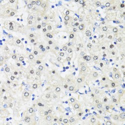 Zinc Finger Protein RFP (TRIM27) Antibody