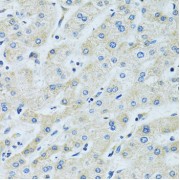 Immunohistochemistry of paraffin-embedded Human liver using SLC5A6 Antibody (1/100 dilution, 40x lens).