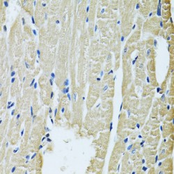 Solute Carrier Family 5 Member 6 (SLC5A6) Antibody