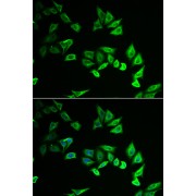 Immunofluorescence analysis of U2OS cells using MYOZ2 Antibody