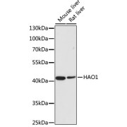 Western blot analysis of extracts of various cell lines using HAO1 Antibody (1/50 dilution)0.