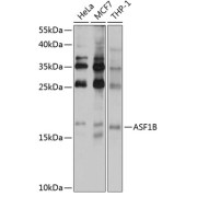 Western blot analysis of extracts of various cell lines using ASF1B Antibody (1/1000 dilution).