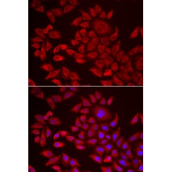 1-Acylglycerol-3-Phosphate O-Acyltransferase 2 (AGPAT2) Antibody