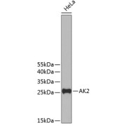 Western blot analysis of extracts of HeLa cells using AK2 Antibody