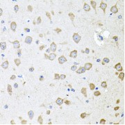 Immunohistochemistry of paraffin-embedded Mouse brain using AKAP5 Antibody (1/100 dilution, 40x lens).