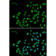 Immunofluorescence analysis of U2OS cells using CTNNBL1 Antibody