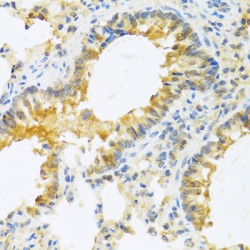 Interleukin 20 (IL20) Antibody