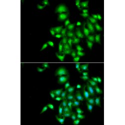 Interleukin 20 (IL20) Antibody