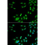 Immunofluorescence analysis of A549 cells using INTS10 Antibody