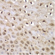 Immunohistochemistry of paraffin-embedded Human esophagus using INTS5 Antibody (1/100 dilution, 40x lens).