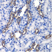 Immunohistochemistry of paraffin-embedded Rat kidney using MATK Antibody (1/100 dilution, 40x lens).