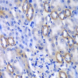 Megakaryocyte Associated Tyrosine Kinase (MATK) Antibody