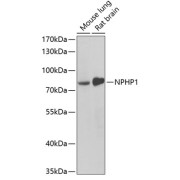 Western blot analysis of extracts of various cell lines using NPHP1 Antibody (1/1000 dilution).