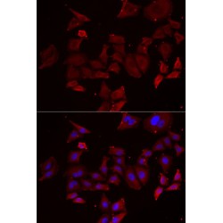 Nephrocystin 1 (NPHP1) Antibody