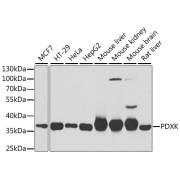 Western blot analysis of extracts of various cell lines using PDXK Antibody (1/1000 dilution).