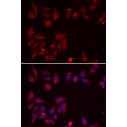 Pyridoxal Kinase (PDXK) Antibody