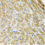 Immunohistochemistry of paraffin-embedded Rat heart using POLG2 Antibody (1/100 dilution, 40x lens).